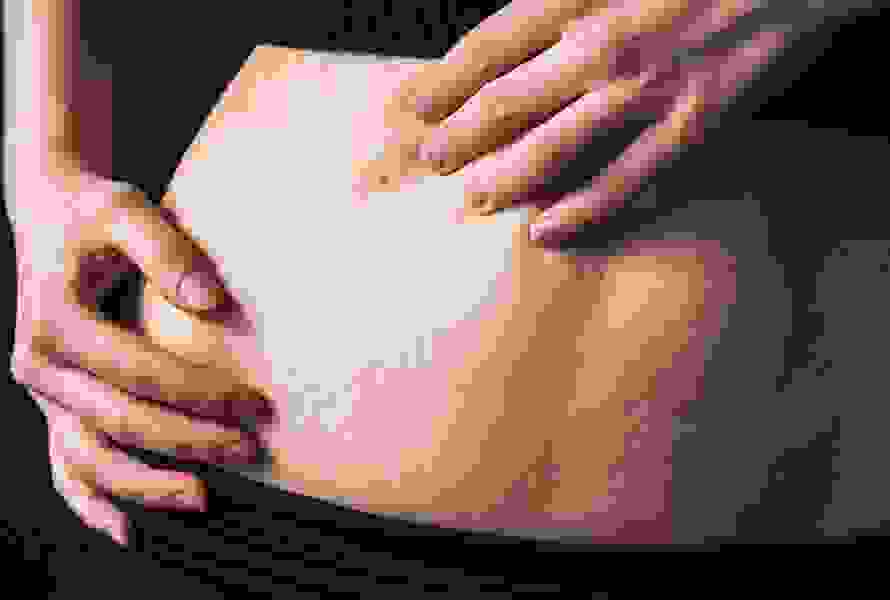Nahaufnahme einer schwangeren Frau, die mit der Hand ihre Bauchhaut berührt, auf der sich erste Schwangerschaftsstreifen zeigen.